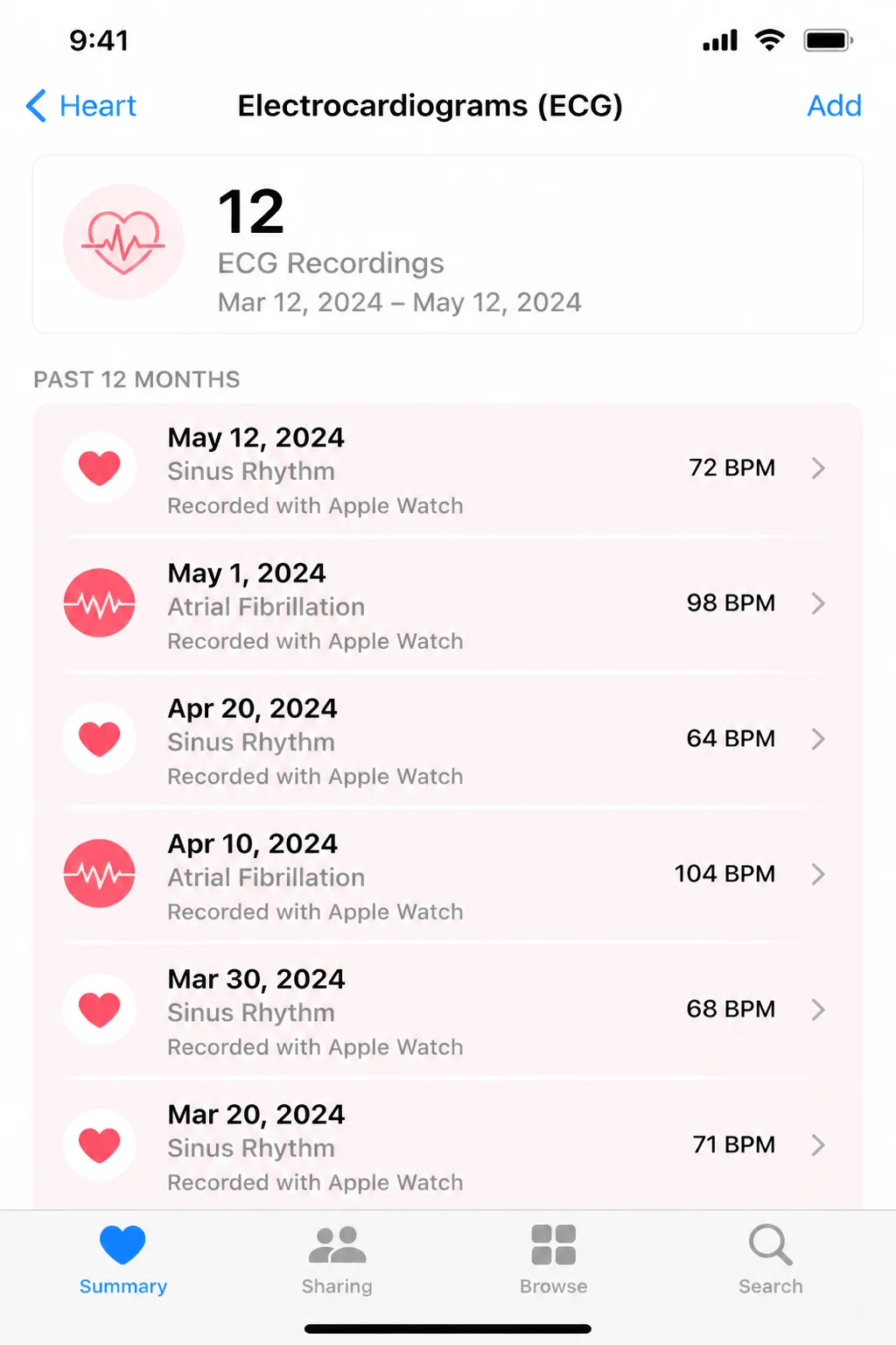 Health app list of past ECG readings showing dates and classification labels