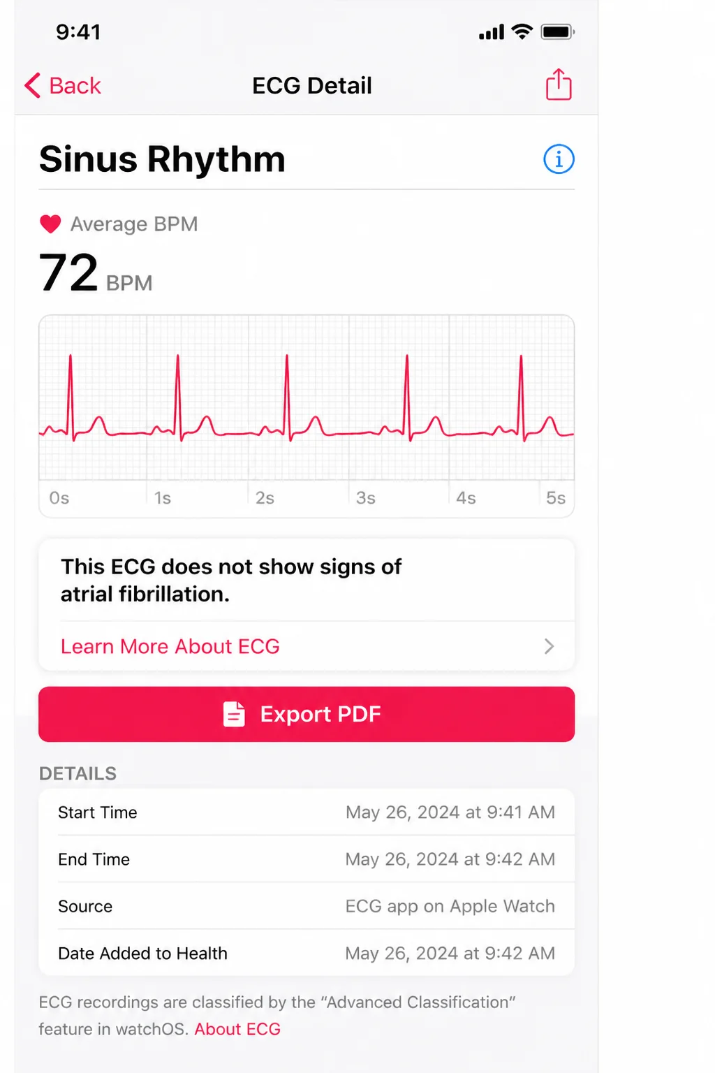Individual ECG reading detail view in the Health app with the Export PDF / Share option visible